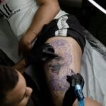 A Step by Step Guide to Your Tattoo Removal Journey Tattoo Removal Journey