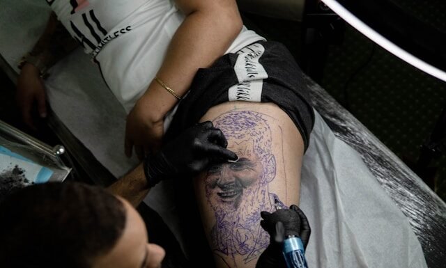 A Step by Step Guide to Your Tattoo Removal Journey Tattoo Removal Journey