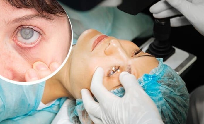How to Choose the Best Eye Hospital in Dubai